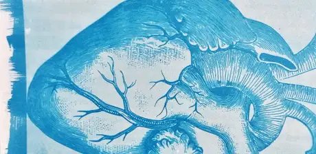 Cyanotypie im Hamburger Bahnhof