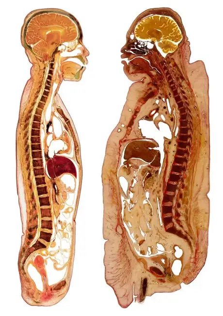 KÖRPERWELTEN Museum Berlin