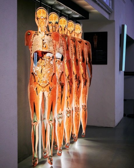 KÖRPERWELTEN Museum Berlin