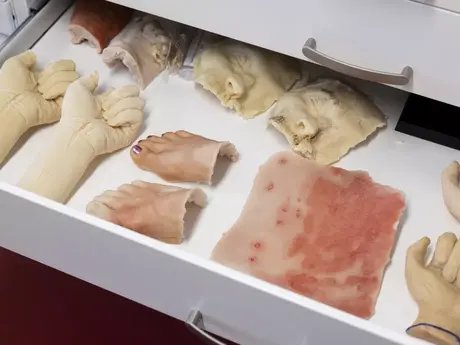 Ausgewählte Moulagen in Schublade