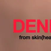 DENNIS // from skin(head) to bone