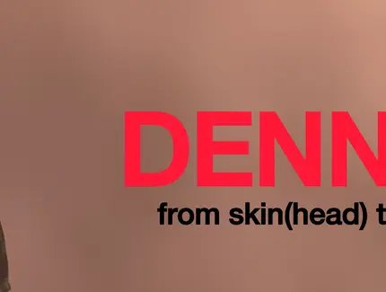 DENNIS // from skin(head) to bone