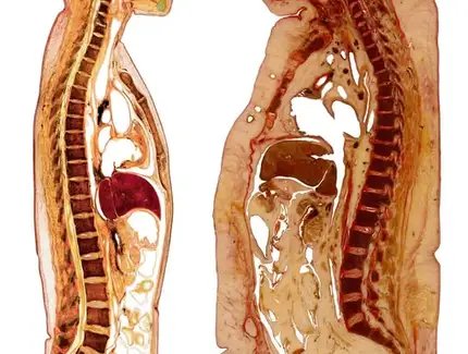 KÖRPERWELTEN Museum Berlin