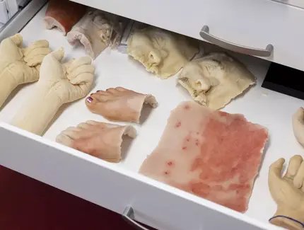 Ausgewählte Moulagen in Schublade